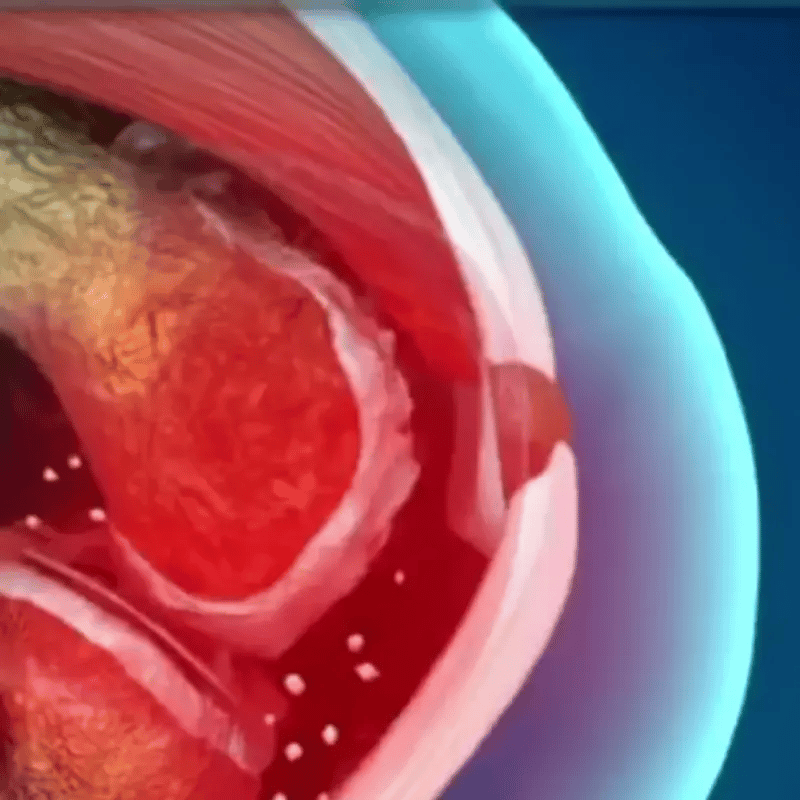 Rodilla Sana X10 | Alivio natural en minutos