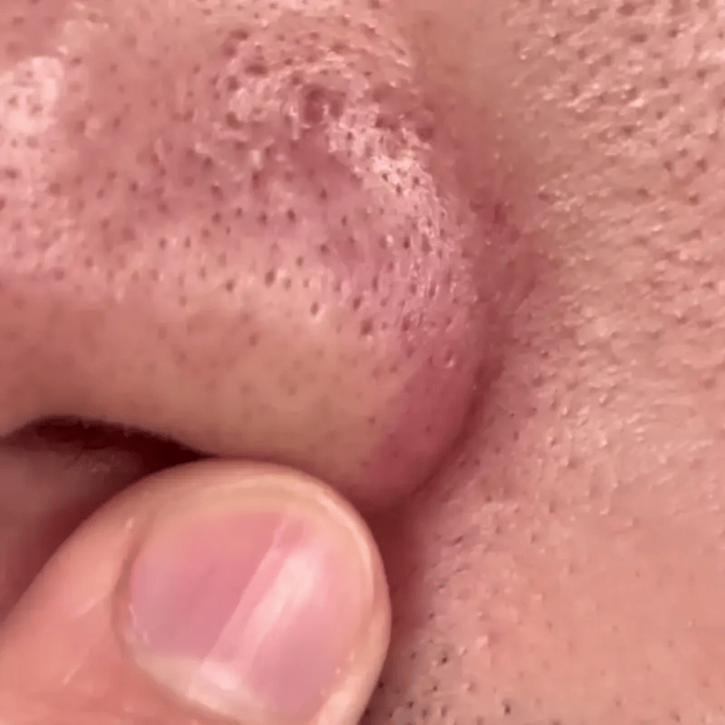 Aceite Bifásico | Cero irritación, solo suavidad y frescura