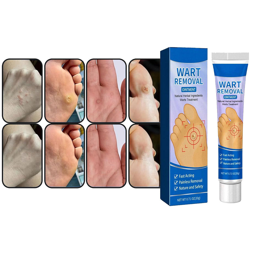 Wart-Removal | Elimina Verrugas en días sin molestias