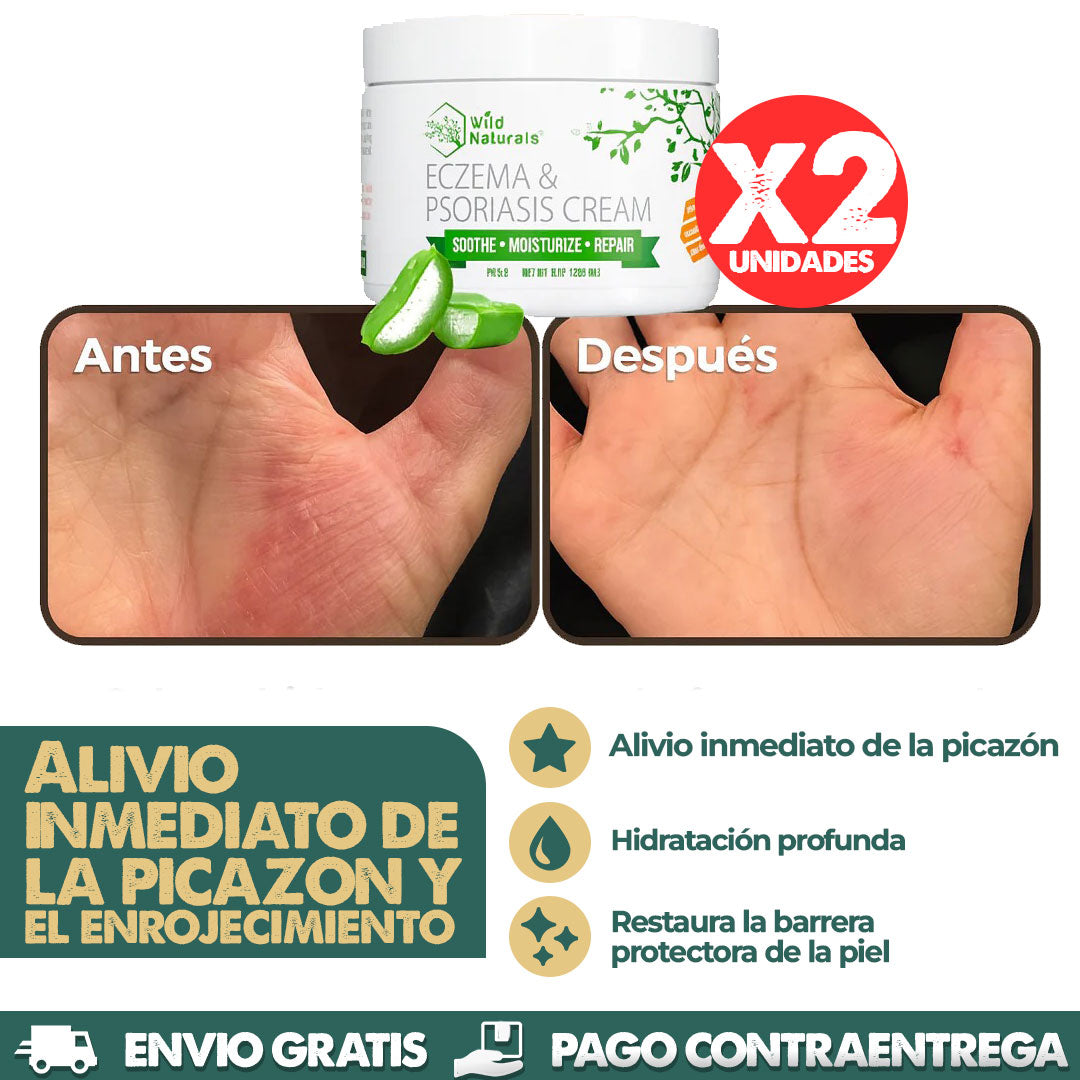 Eczema & Psoriasis Cream X2 UNIDADES | Dile adiós a la irritación y molestias