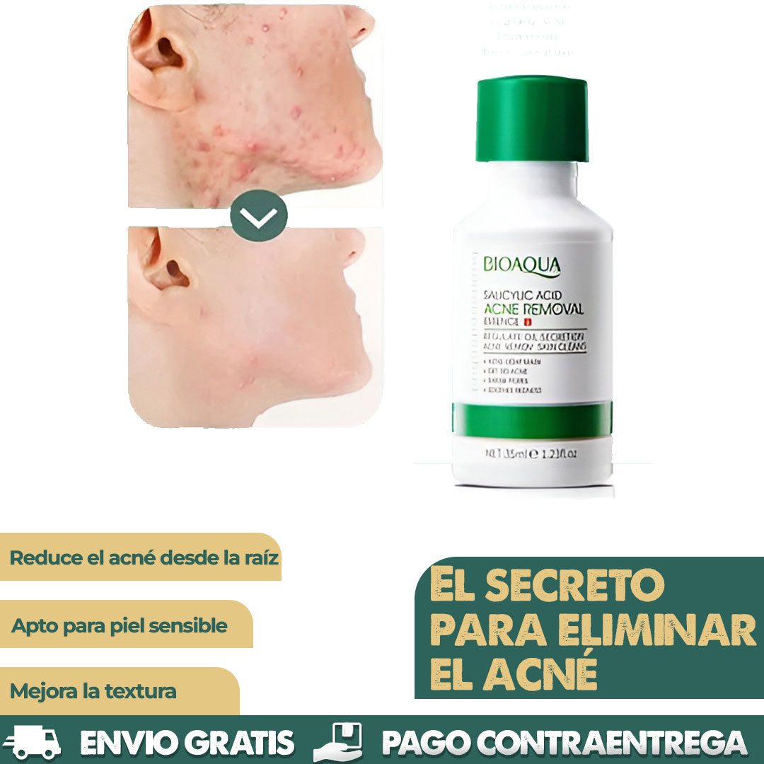 Acido Salicilico Bioaqua | Dile adiós al acné!