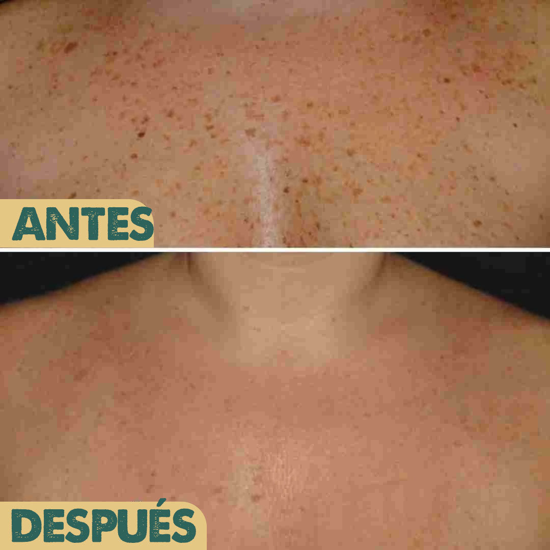 BEE VENOM 2x1 | Elimina el dolor, recomendada por dermatologos