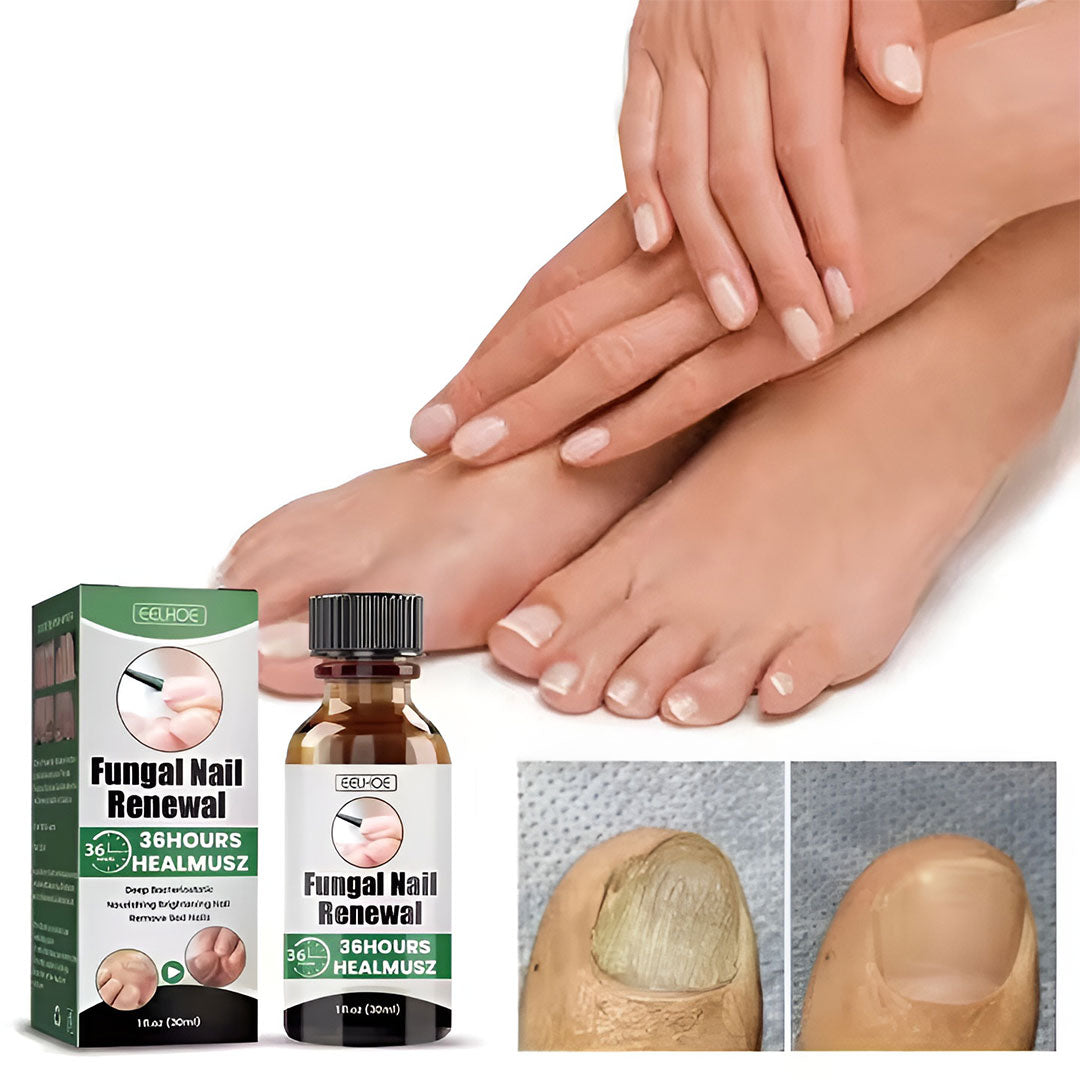 Nail Cure Pro | Tratamiento avanzado para hongos en las uñas