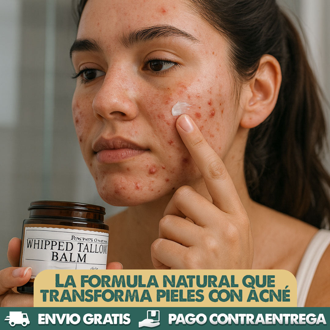 WHIPPED TALLOW BALM | Bálsamo natural que elimina el acné