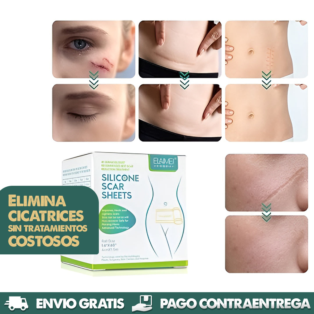 ScarErase™ | Eliminación de Cicatrices sin Dolor *1.5 METROS