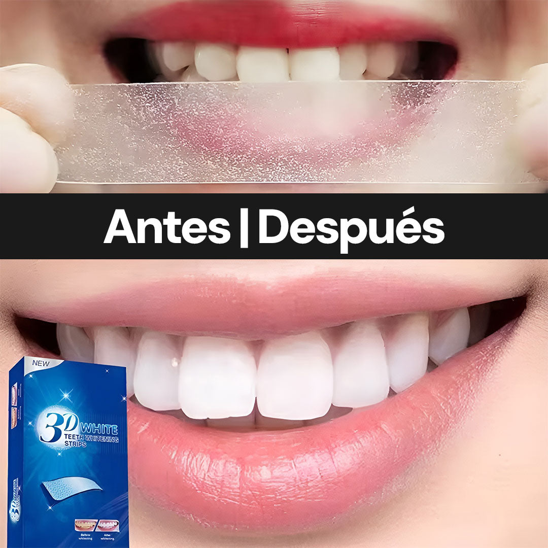 GlowSmile – Blanquea tu Sonrisa Fácilmente
