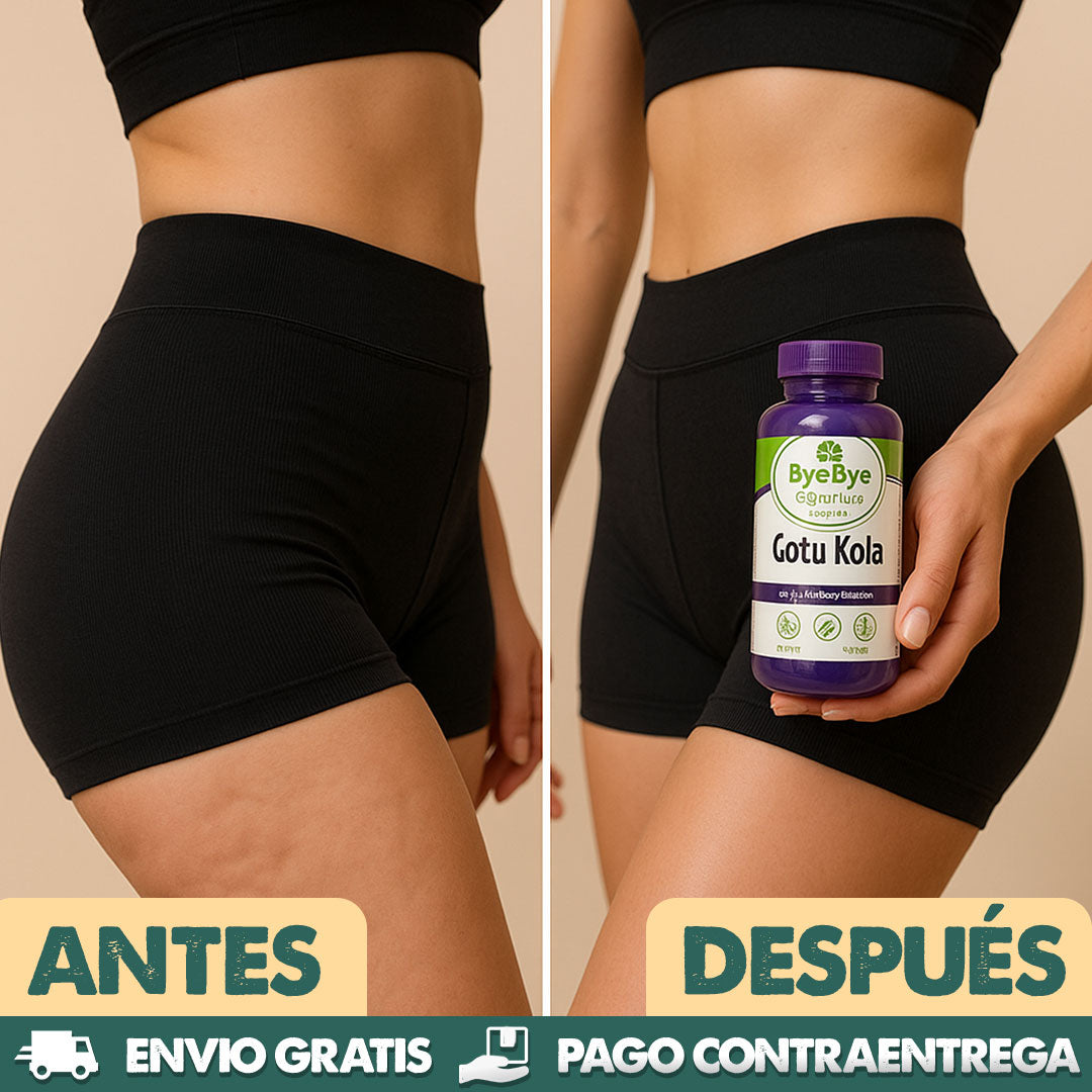 Bye bye | Tratamiento Herbal Anti Celulitis