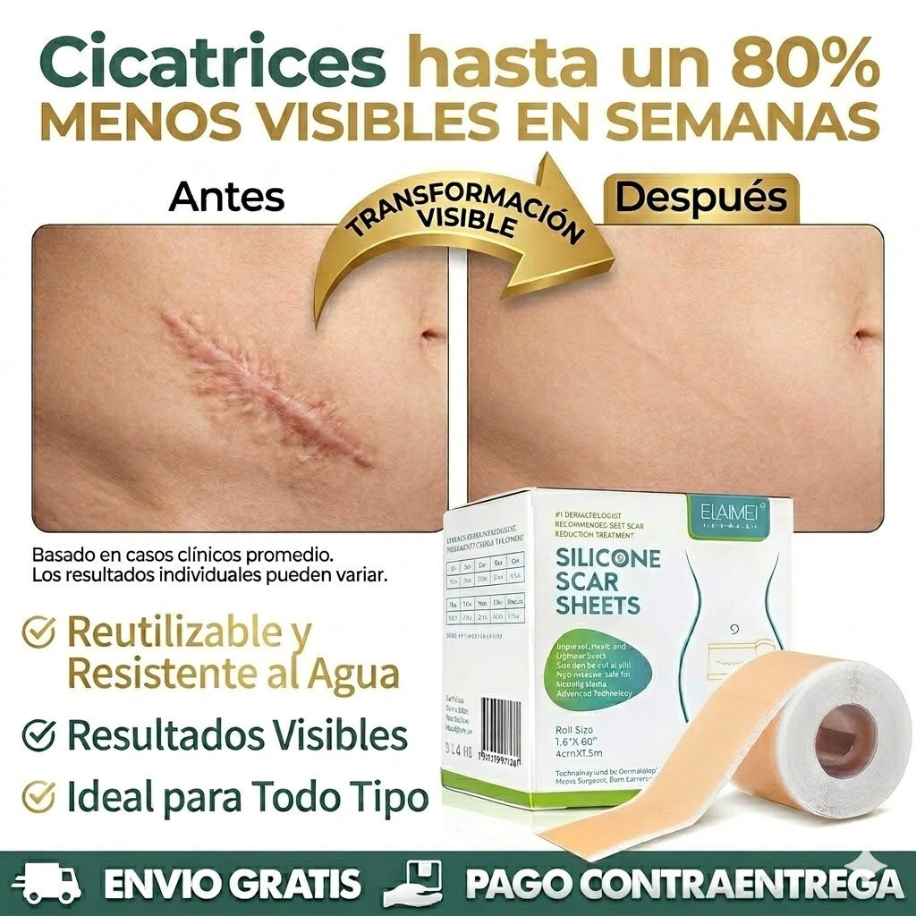 Silicone Marks Sheet | Adiós cicatrices y líneas de expresión desde la primera semana