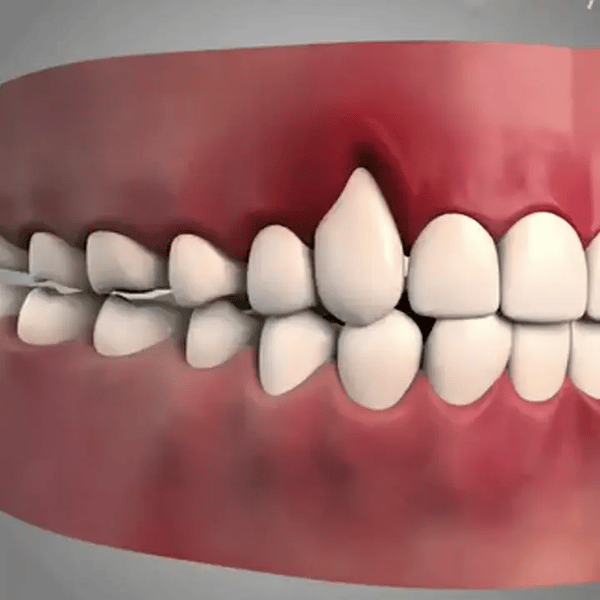 Persona con dientes amarillos triste