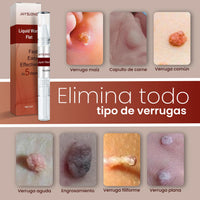 Removedor Rápido de Verrugas y Acné con Punta de Precisión - Pack 2 - 4