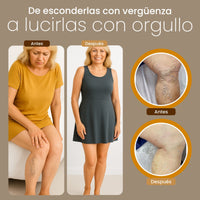 Crema de Alivio Intenso para Piernas: Dile adiós a Varices y Hinchazón | Alivio instantáneo - 4