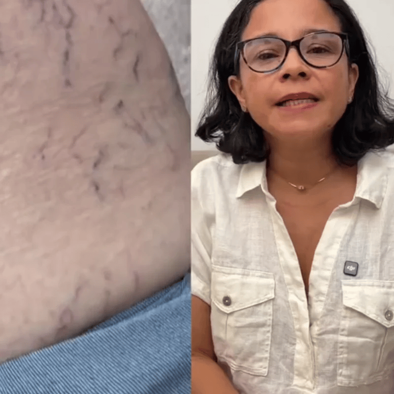 Liposomal Vitamin C - Mejora circulación y varices – Tienda Ecuador