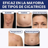 Cinta de Silicona Profesional para Cicatrices y Líneas de Expresión | 1.5 metros - 3