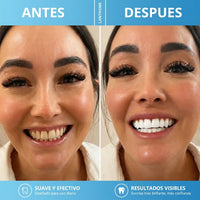 Lápiz Blanqueador Dental Instantáneo | Adiós Dientes Amarillos  x2 unidades - 2