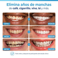 Lápiz Blanqueador Dental Instantáneo | Adiós Dientes Amarillos  x2 unidades - 4