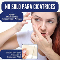Cinta de Silicona Profesional para Cicatrices y Líneas de Expresión | 1.5 metros - 2