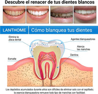 Lápiz Blanqueador Dental Instantáneo | Adiós Dientes Amarillos  x2 unidades - 3