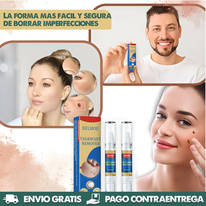 ¡Elimina Verrugas Rápido y Sin Dolor! | Lápiz Removedor Profesional x2 UNIDADES! ✨