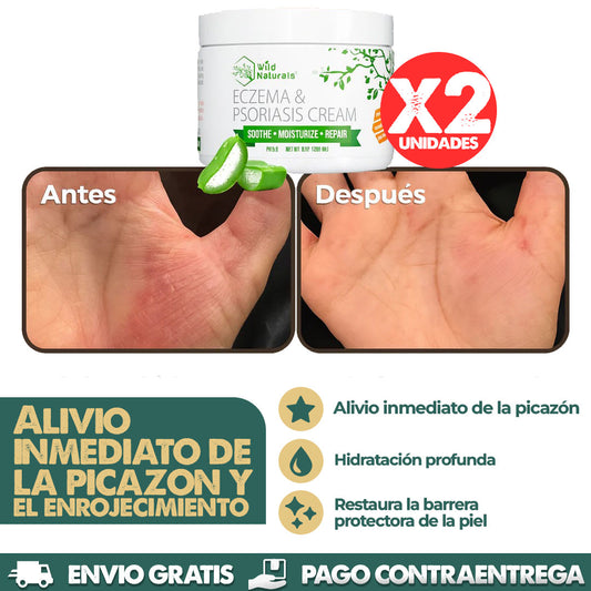 Eczema & Psoriasis Cream X2 UNIDADES | Dile adiós a la irritación y molestias