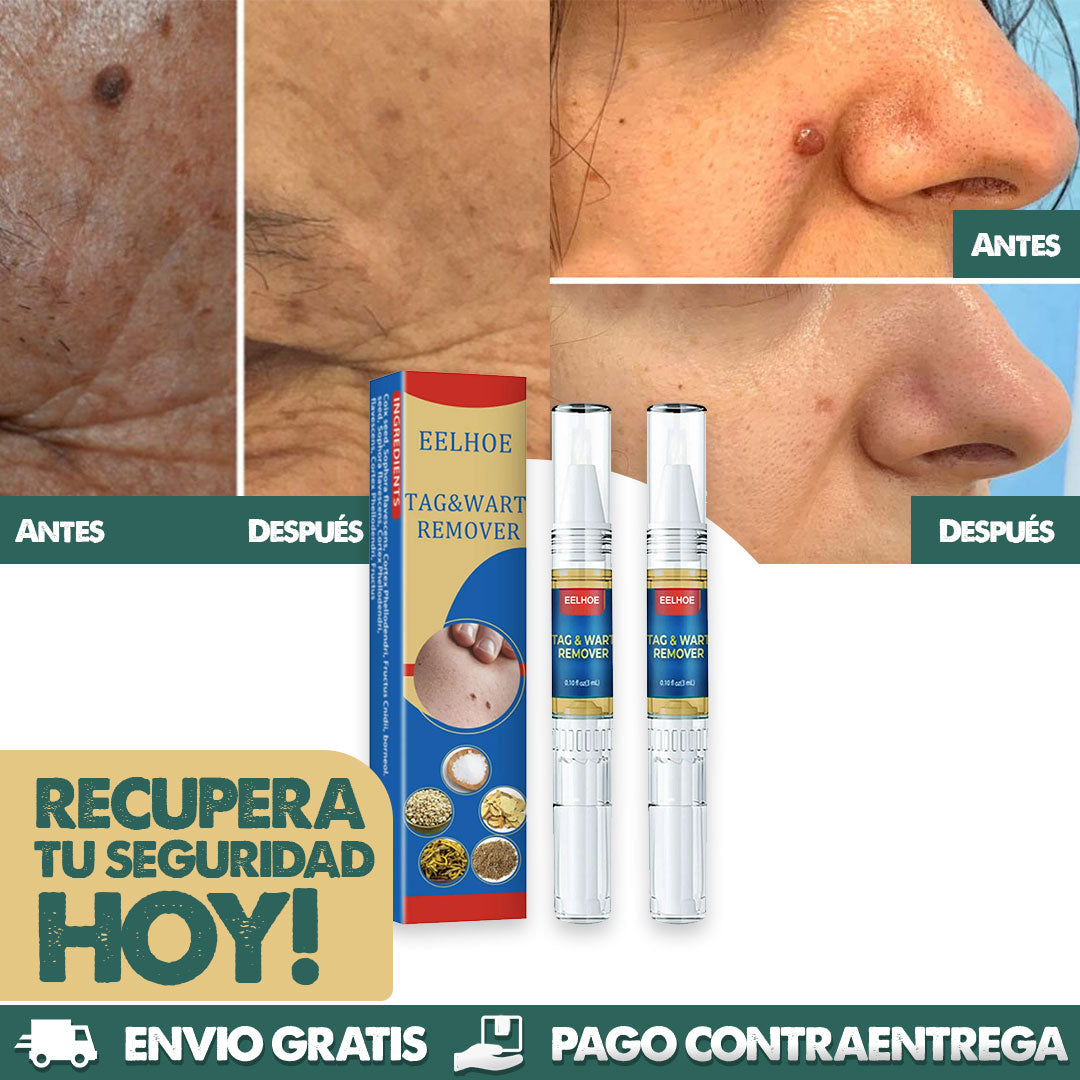 ¡Elimina Verrugas Rápido y Sin Dolor! | Lápiz Removedor Profesional x2 UNIDADES ✨