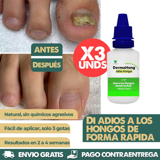 Dermahong x3 Unidades | Dile adiós a los hongos y recupera tu confianza