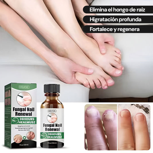 Nail Cure Pro | Tratamiento avanzado para hongos en las uñas