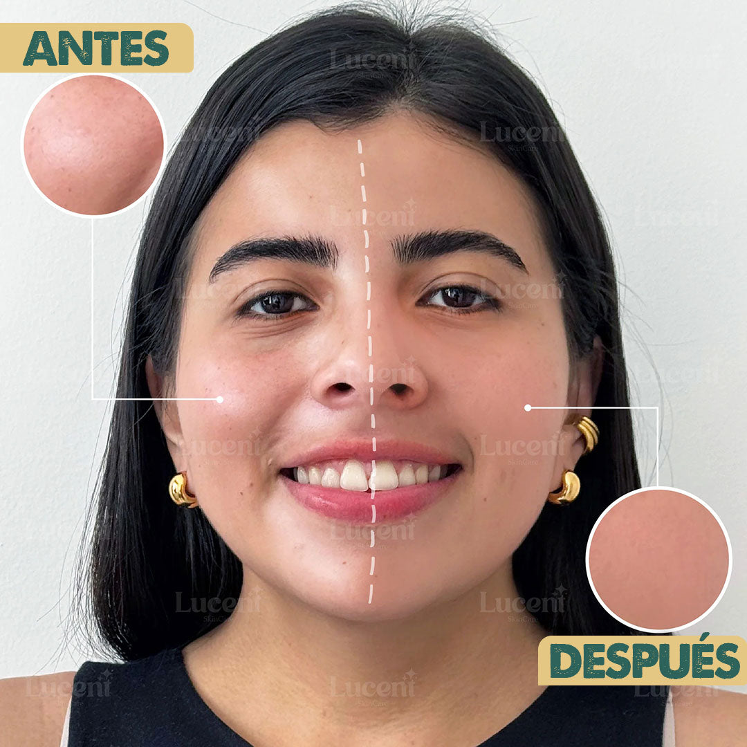 Candy Bella | Gel prensado para control de grasa facial