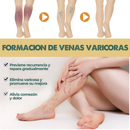 VeinX Varicose X2 UNIDADES | Dile adiós a las venas varicosas