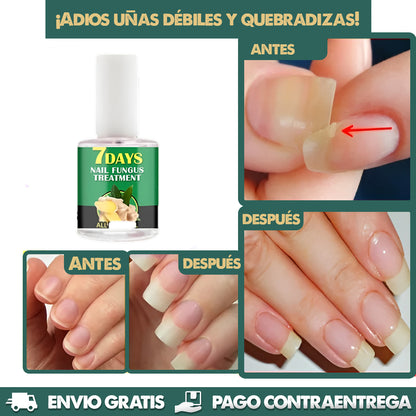 NailBoost Pro | Crecimiento acelerado en 7 días