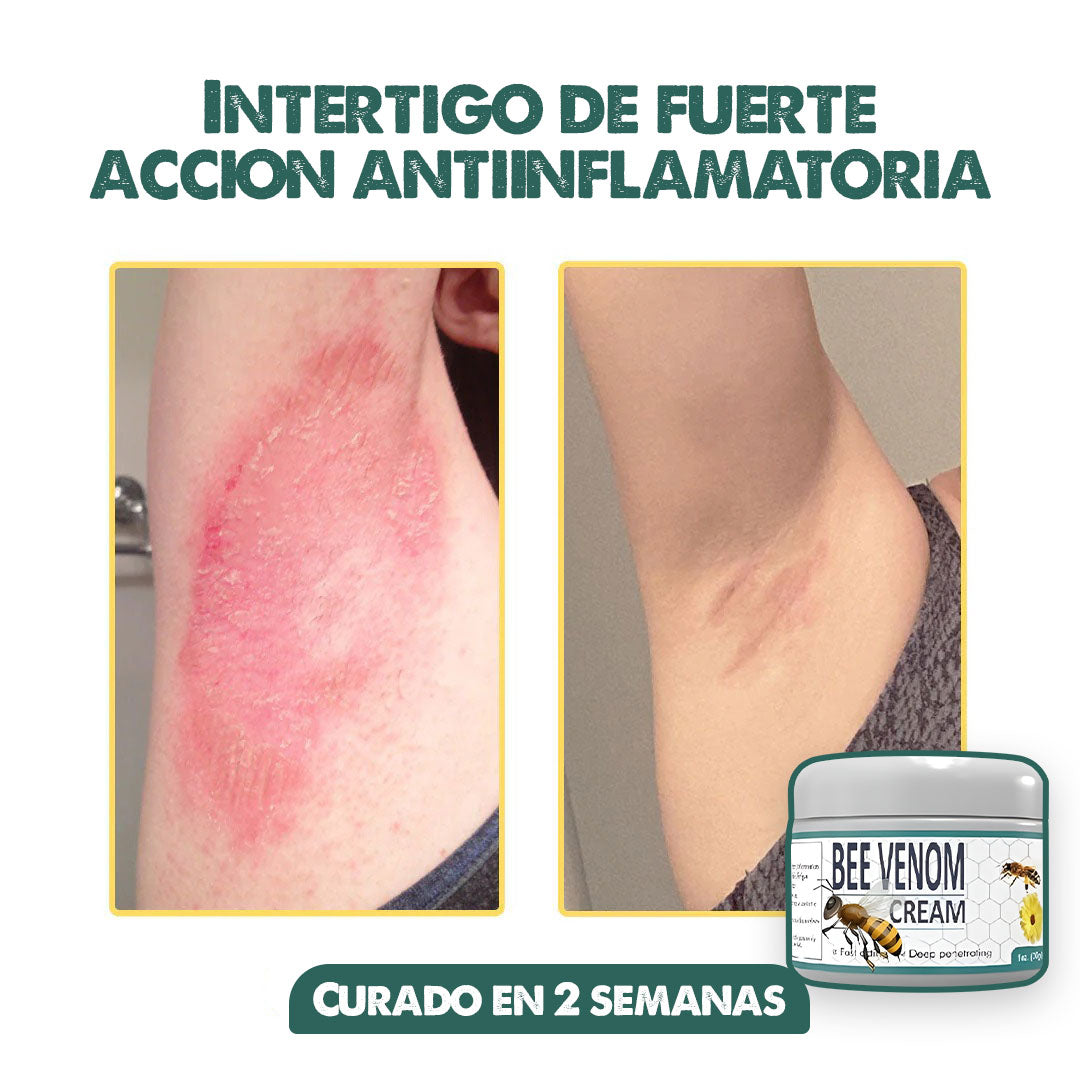 BEE VENOM 2x1 | Elimina el dolor, recomendada por dermatologos