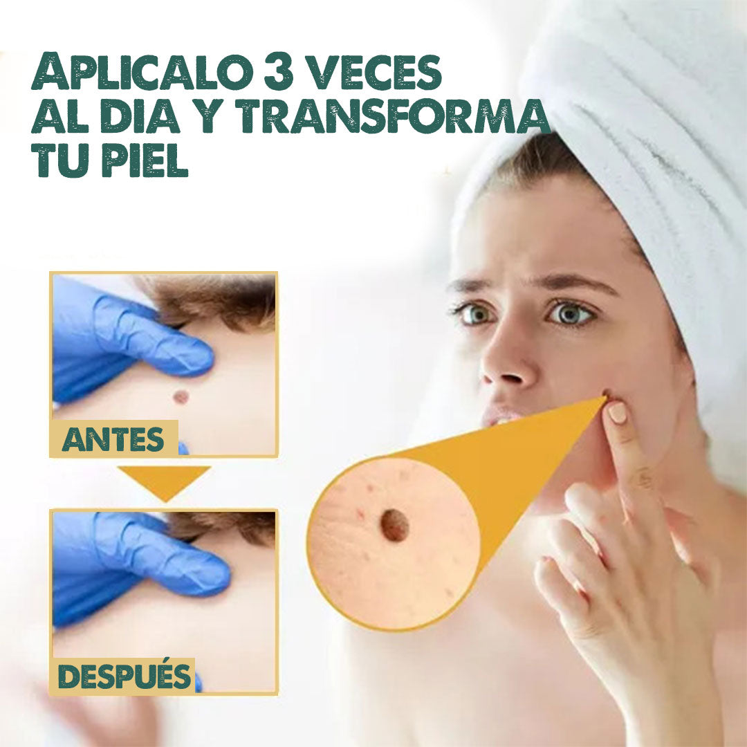 BEE SPRAY | Elimina imperfecciones de la piel