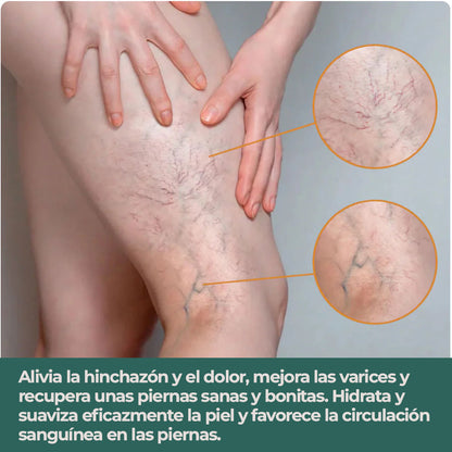 VeinX Varicose X2 UNIDADES | Dile adiós a las venas varicosas