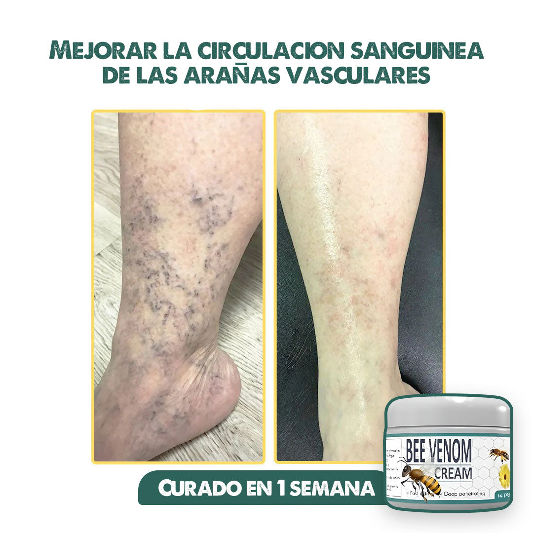 BEE VENOM 2x1 | Elimina el dolor, recomendada por dermatologos