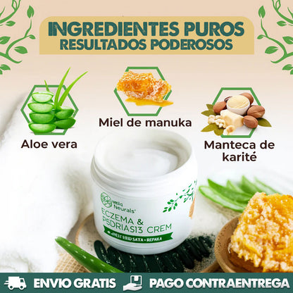 Eczema & Psoriasis Cream X2 UNIDADES | Dile adiós a la irritación y molestias