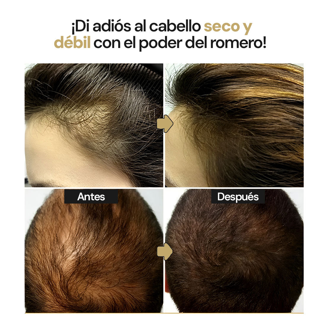 Eelhoe Crecimiento Capilar | Dile adiós a la calvicie