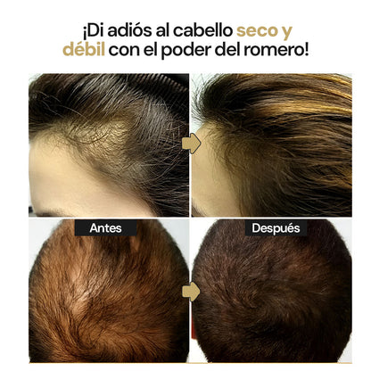 Eelhoe Crecimiento Capilar | Dile adiós a la calvicie
