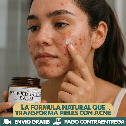 WHIPPED TALLOW BALM | Bálsamo natural que elimina el acné