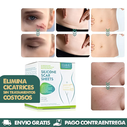 ScarErase™  | Eliminación de Cicatrices sin Dolor *1.5 METROS