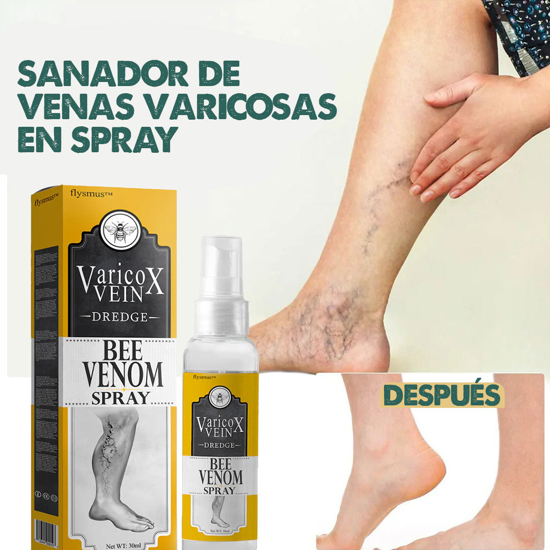 VeinX Varicose X2 UNIDADES | Dile adiós a las venas varicosas