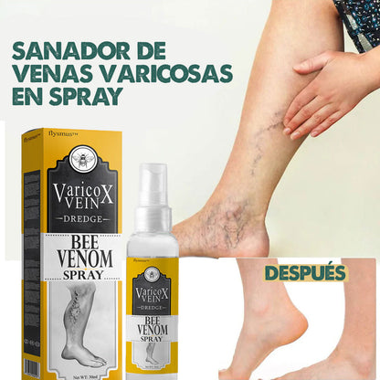 VeinX Varicose X2 UNIDADES | Dile adiós a las venas varicosas