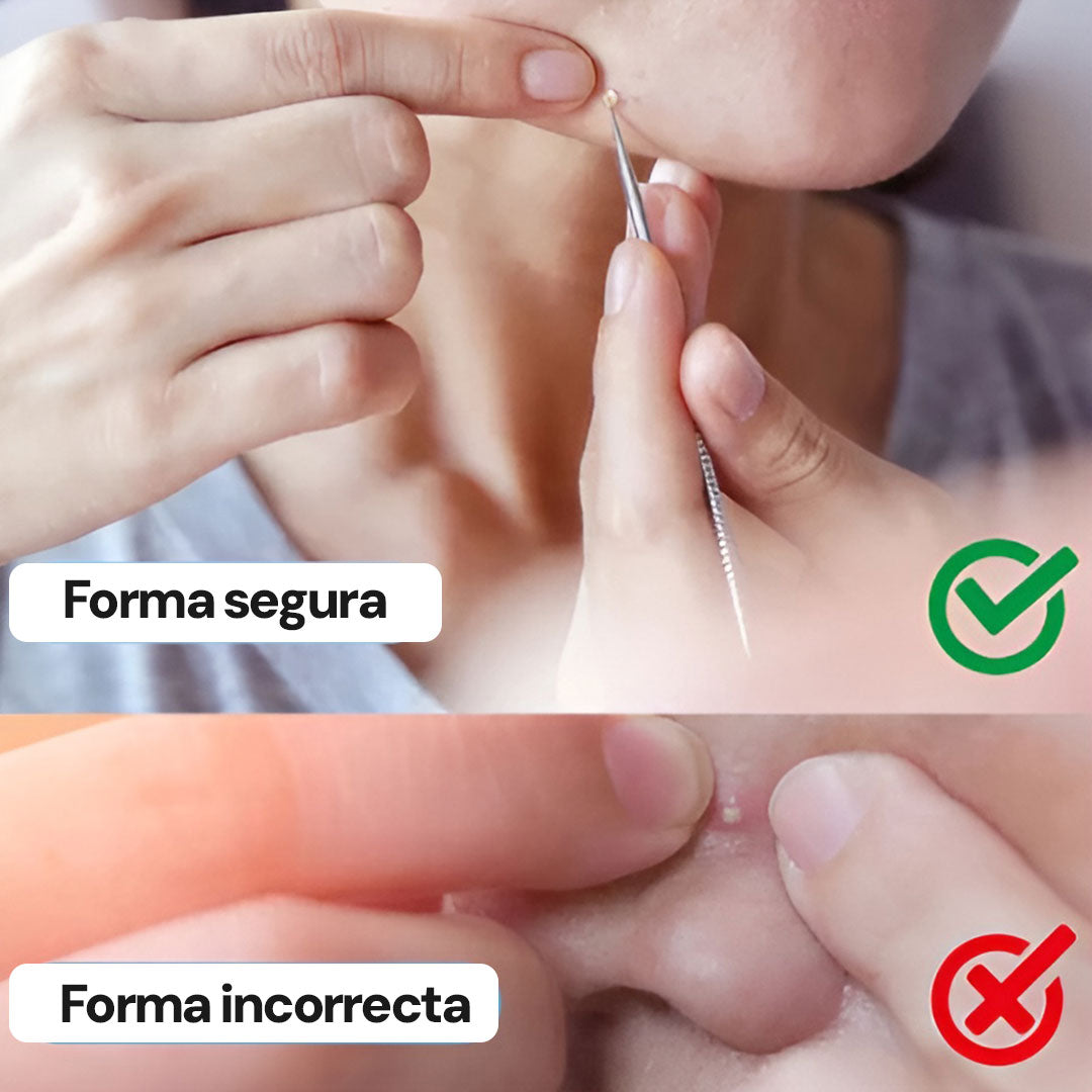 Espinillas Vanish | Pinzas ultrafinas para espinillas * 8 piezas