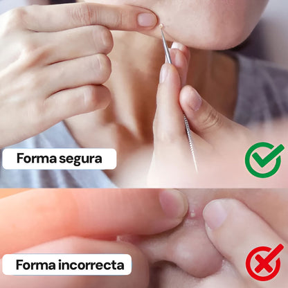 Espinillas Vanish | Pinzas ultrafinas para espinillas * 8 piezas