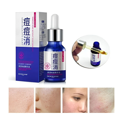 Dermaclear | COMBO Anti Acné Profesional
