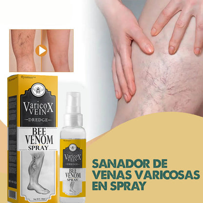 VeinX Varicose X2 UNIDADES | Dile adiós a las venas varicosas
