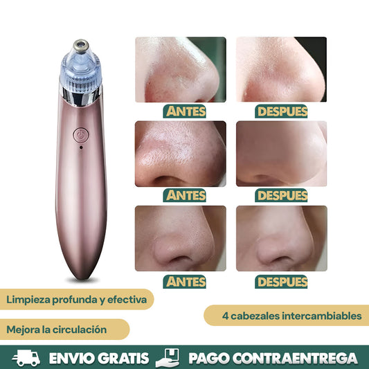 PureSkin Pro | Eliminador de Puntos Negros