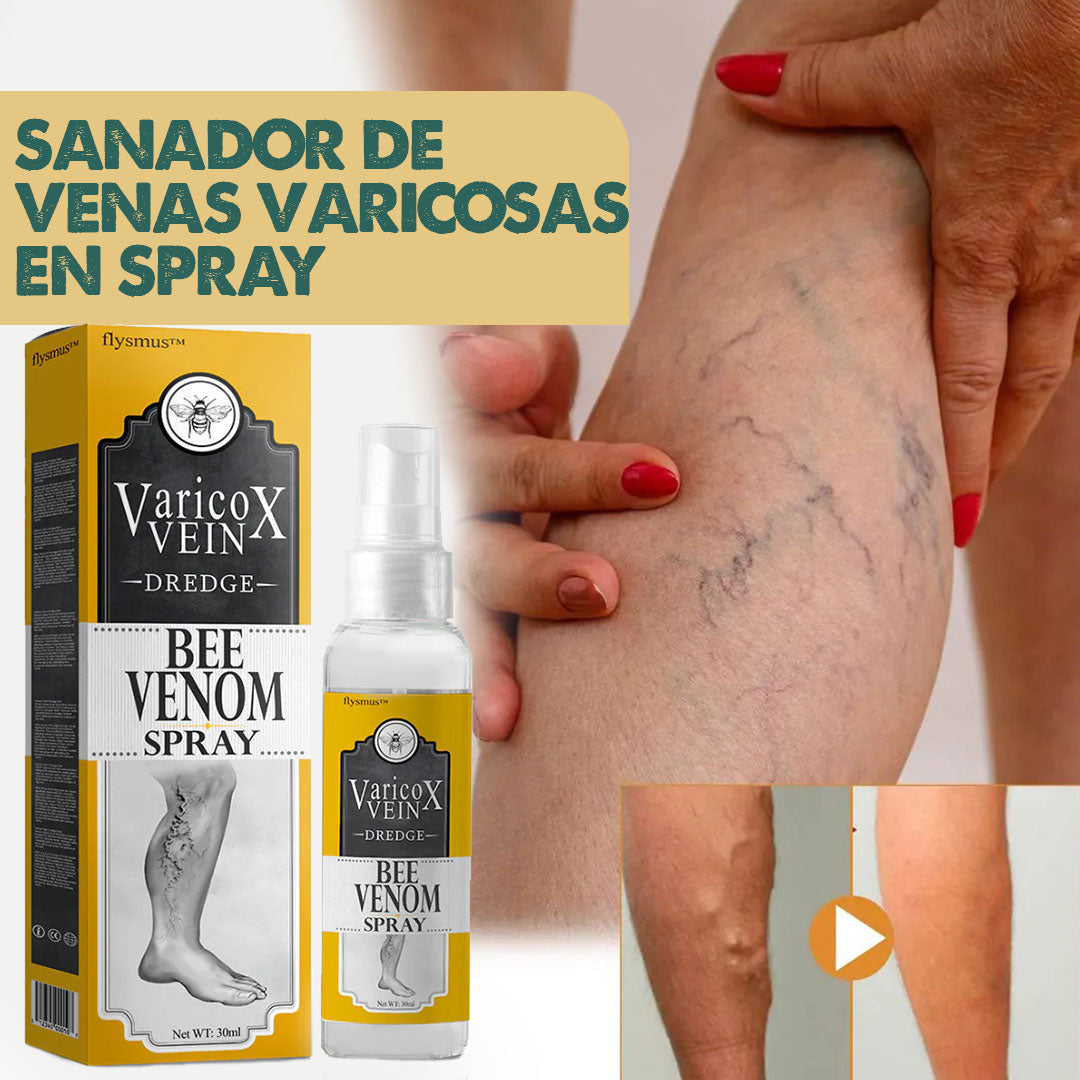 VeinX Varicose X2 UNIDADES | Dile adiós a las venas varicosas