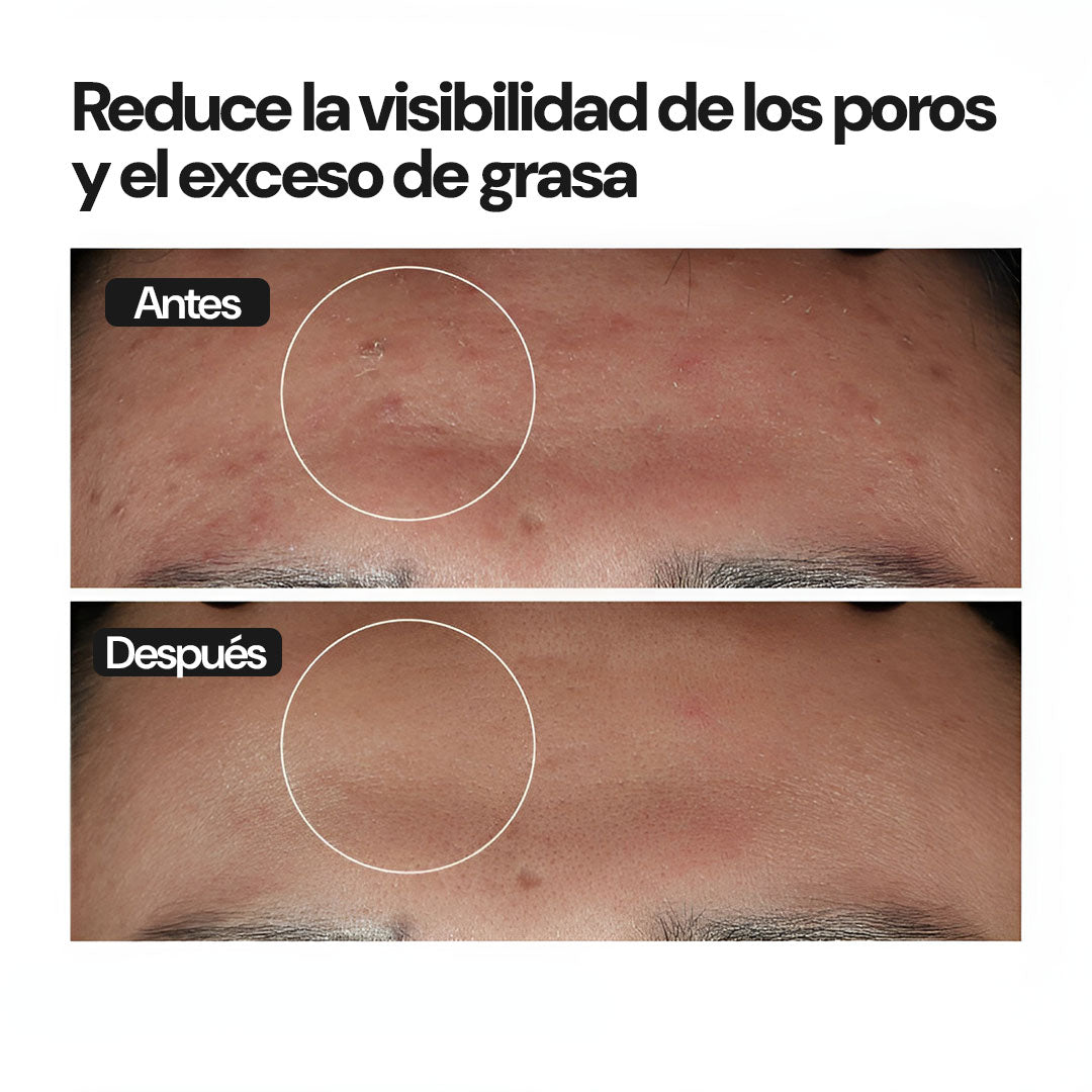 The Originary Niacinamid | Piel impecable, día tras día