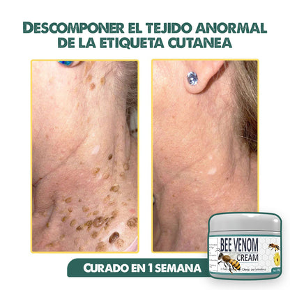 BEE VENOM 2x1 | Elimina el dolor, recomendada por dermatologos