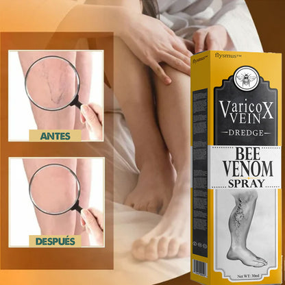 VeinX Varicose X2 UNIDADES | Dile adiós a las venas varicosas