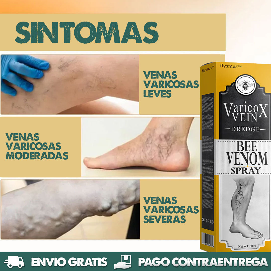 VeinX Varicose X2 UNIDADES | Dile adiós a las venas varicosas